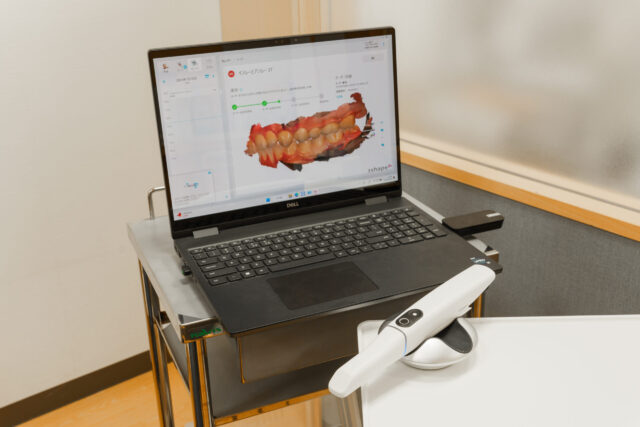 口腔内スキャナー